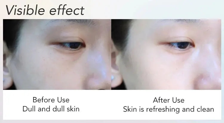 AILKE Whitening Anti-Aging Face Wash, Reduce Wrinkles, Pimples, Oily Skin, Deeply Cleanses & Removes Impurities Facial Cleanser