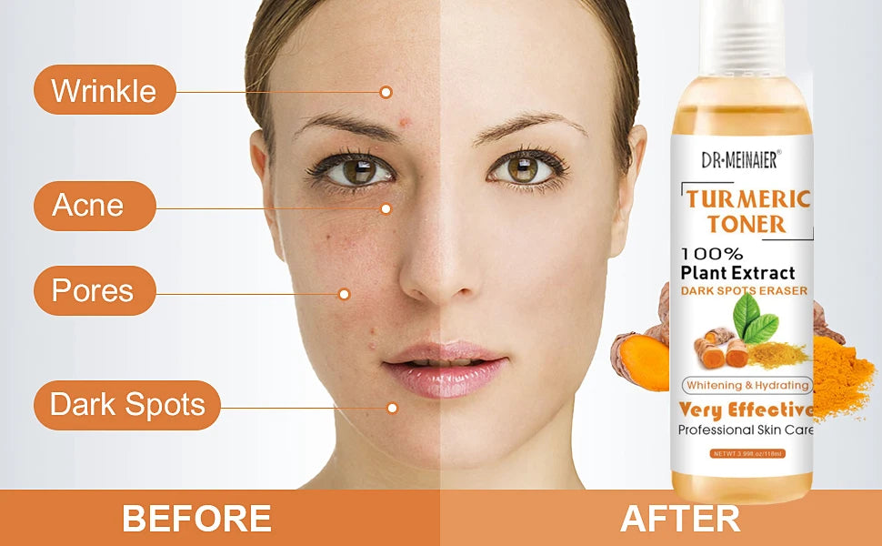 118ml Tumeric Dark Spots Toner Spots Eraser Corrector Turmeric Fade Blemishes Dark Spot Remover Acne Remover Toner for Dark Skin