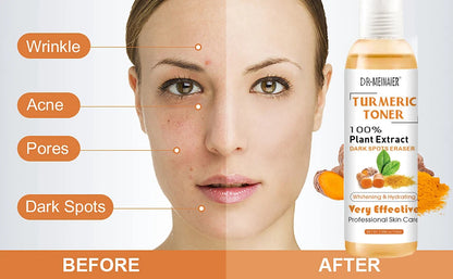 118ml Tumeric Dark Spots Toner Spots Eraser Corrector Turmeric Fade Blemishes Dark Spot Remover Acne Remover Toner for Dark Skin