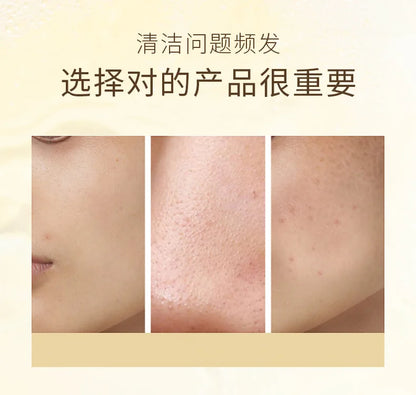 200ml Ginseng Niacinamide Facial Cleanser for Controlling Oil and Moisturizing The Face Skin for Face Beauty