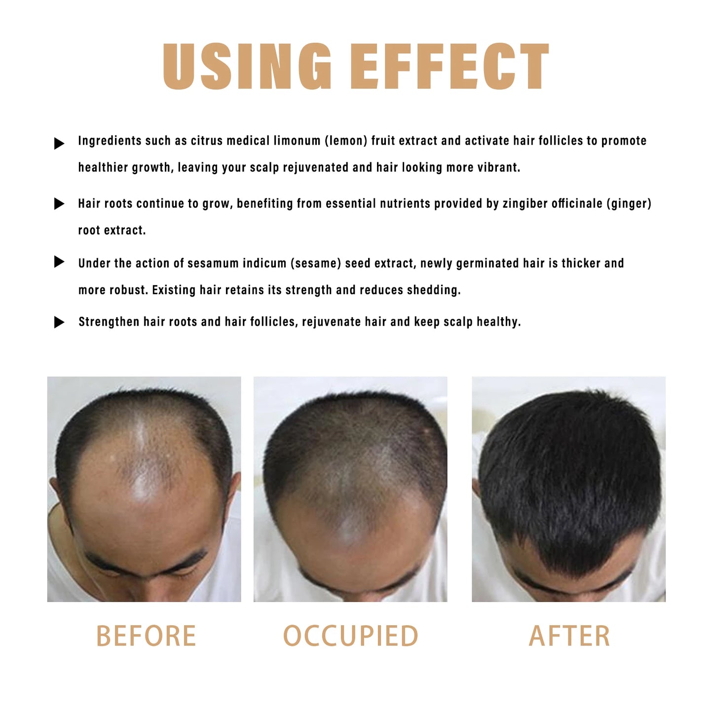 100ml Dense Hair Shampoo Root Activating Shampoo Mane Strengthening Activating Shampoo Dry Frizzy Treatment Deep Nourishment