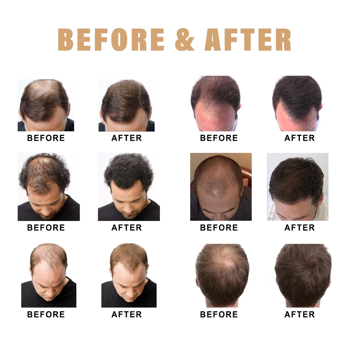 100ml Dense Hair Shampoo Root Activating Shampoo Mane Strengthening Activating Shampoo Dry Frizzy Treatment Deep Nourishment